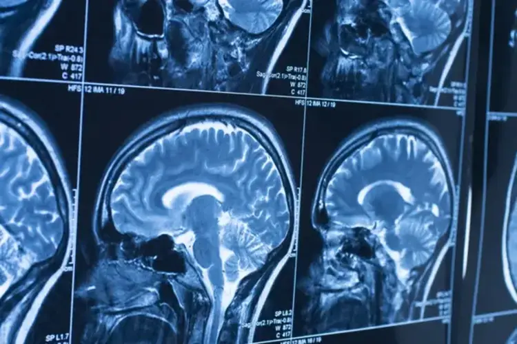 Multiple scans of a brain.